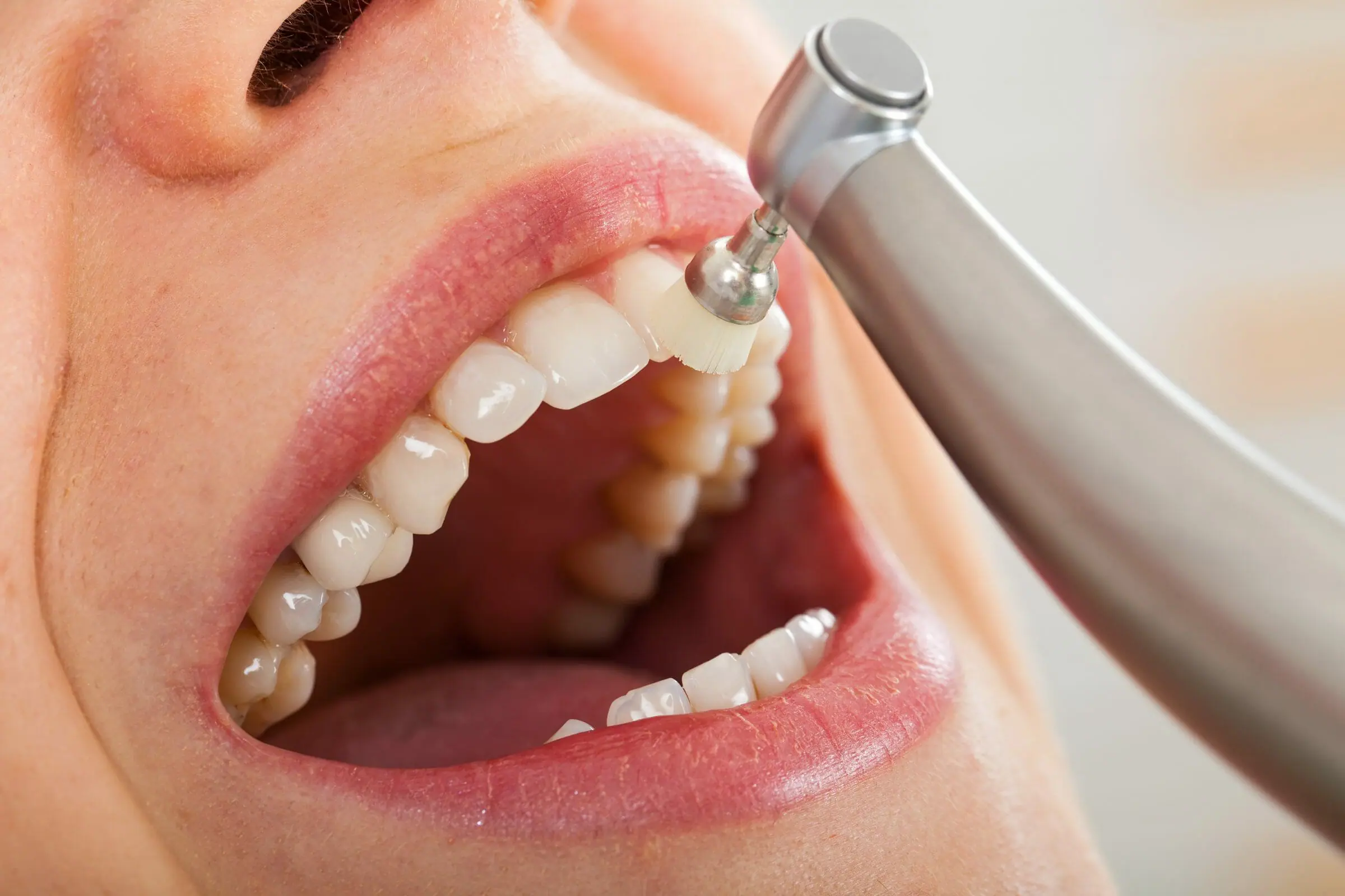 Preventive Dentistry